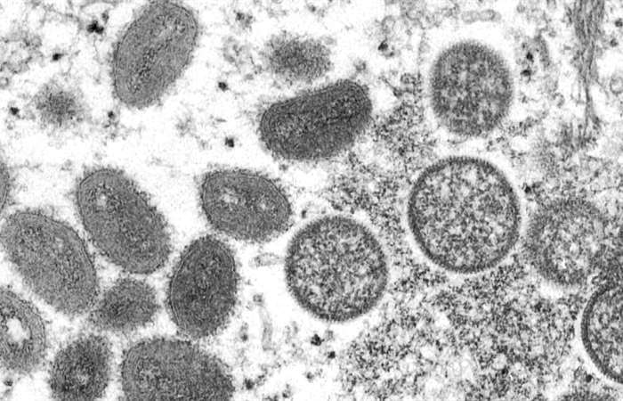 Bỉ ghi nhận ca tử vong đầu tiên do bệnh đậu mùa Khỉ
