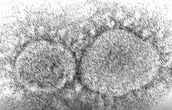 Mỹ phát hiện biến thể mới của virus SARS-CoV-2